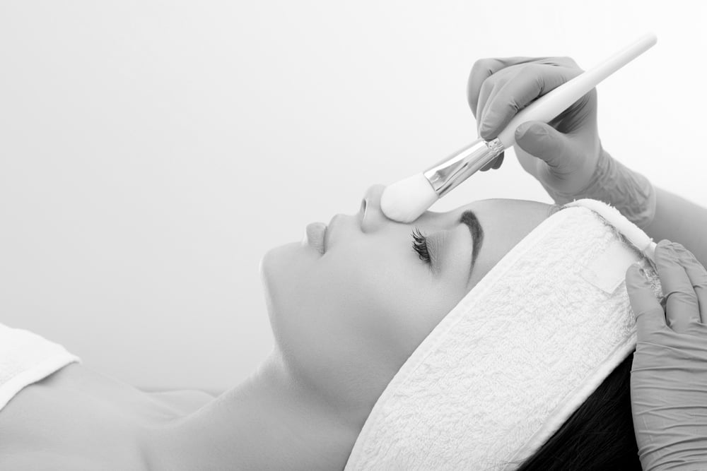 chemical skin peels in Preston
