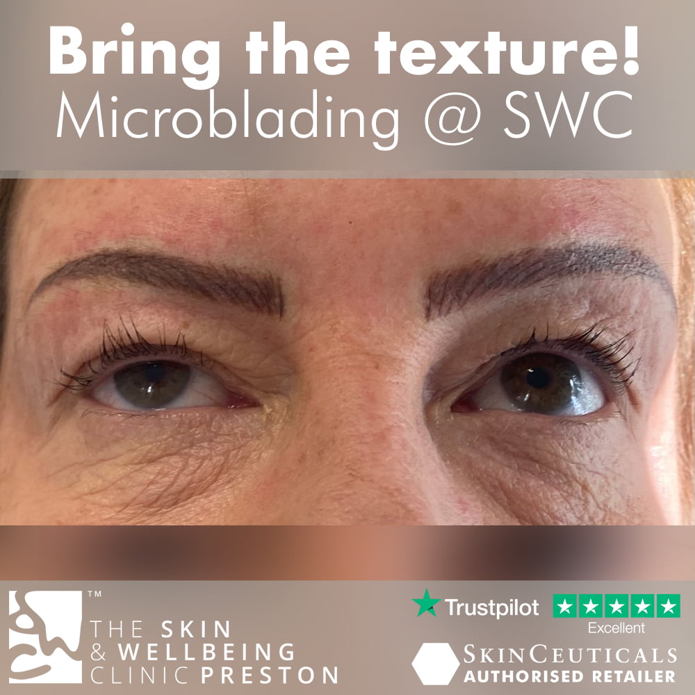 before and after microblading in Preston