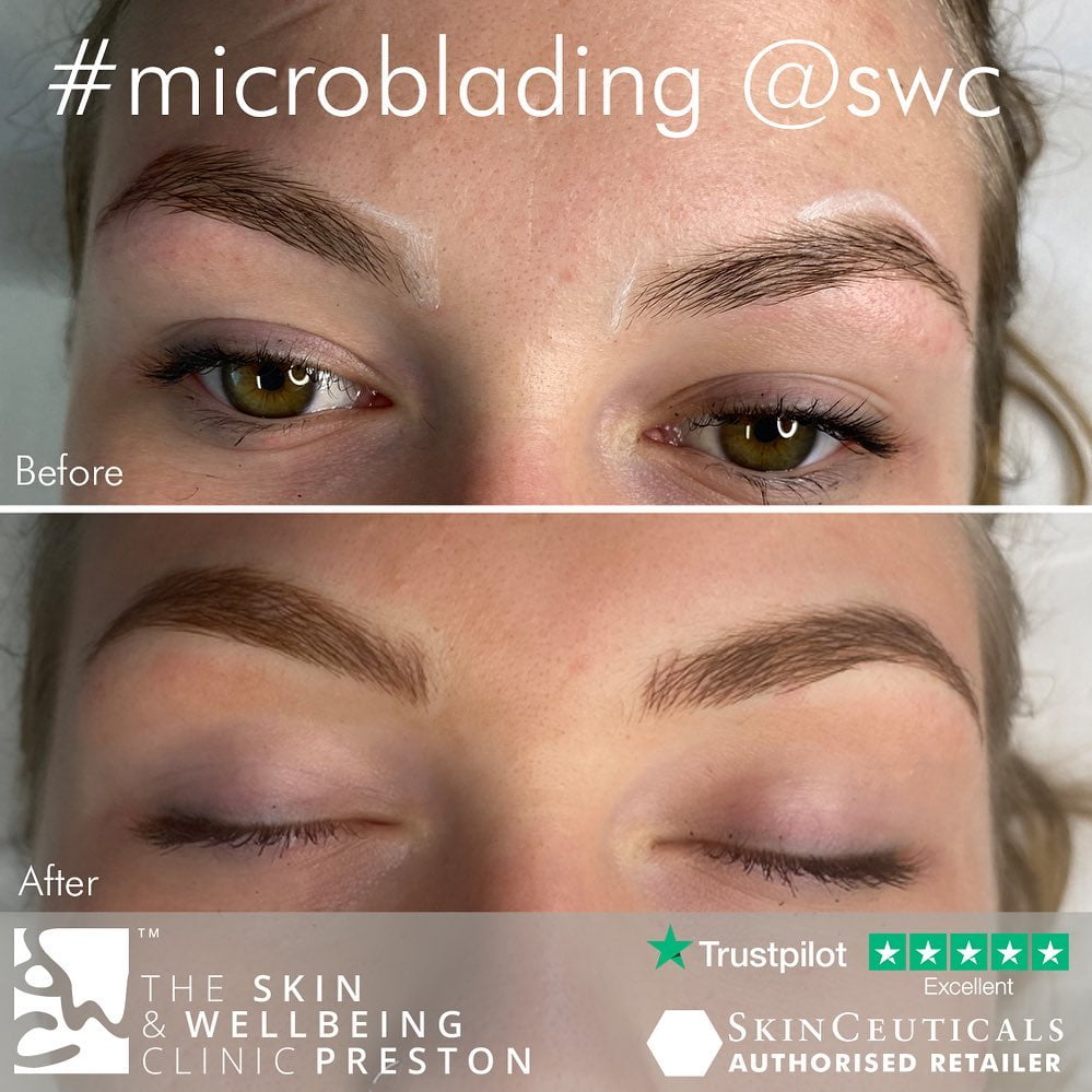microblading in Preston before and after